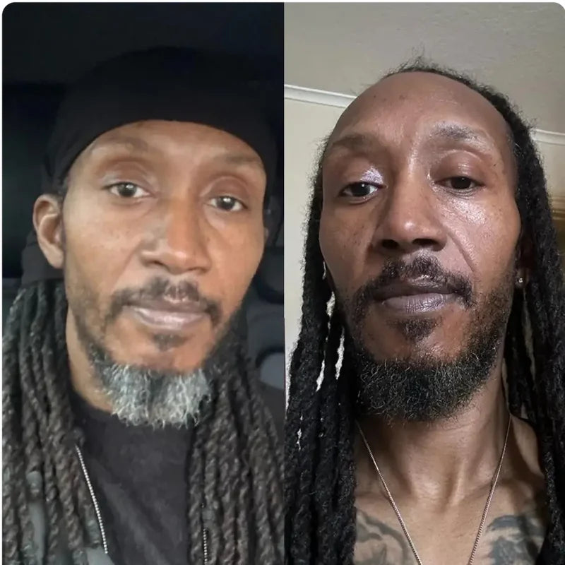 Side-by-side comparison of a man hair.